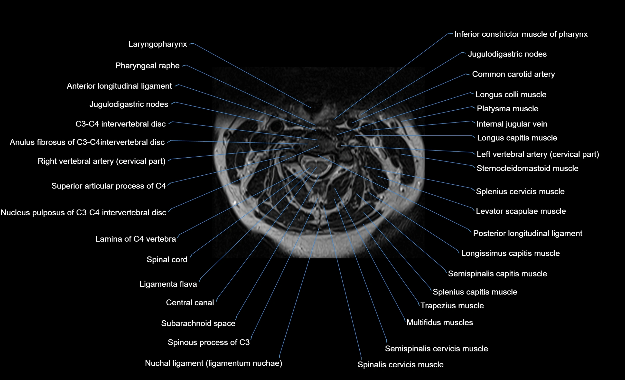 cervical spine cross sectional MRI anatomy  3T MRI axial  image-img-00001-00020.webp